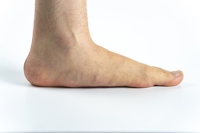 Understanding Causes and Symptoms of Adult Flat Feet