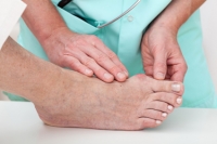 Is Bunion Surgery Right for Me?