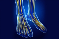Neuropathy and the Feet